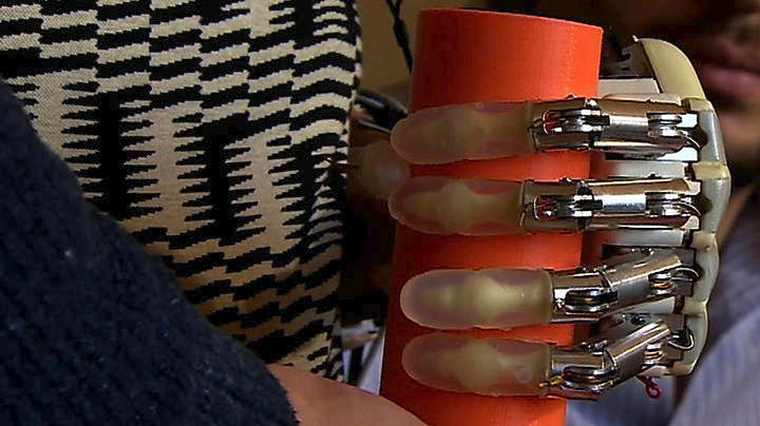 Το 1ο βιονικό χέρι με αίσθηση αφής που μπορεί να φορεθεί εκτός εργαστηρίου