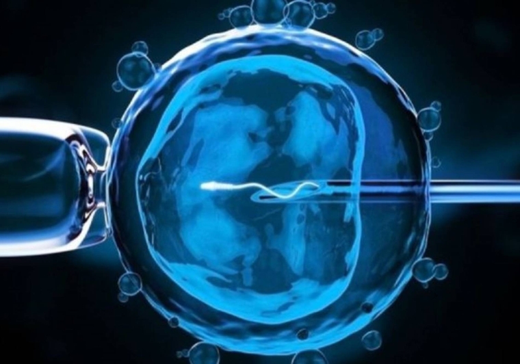 Πρωτοποριακή μέθοδος για άμεση επιλογή φύλου στην τεχνητή γονιμοποίηση