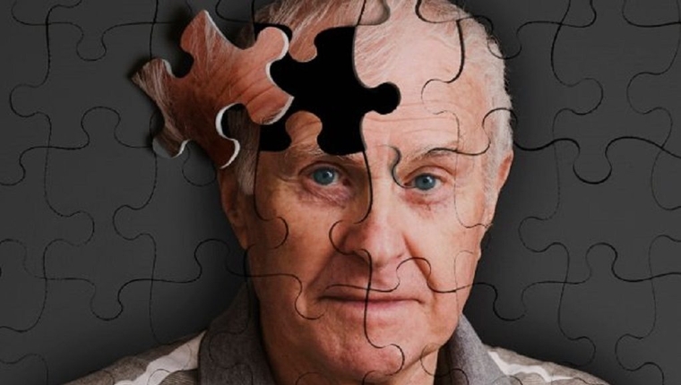 Είκοσι χρόνια νωρίτερα η διάγνωση του Αλτσχάιμερ