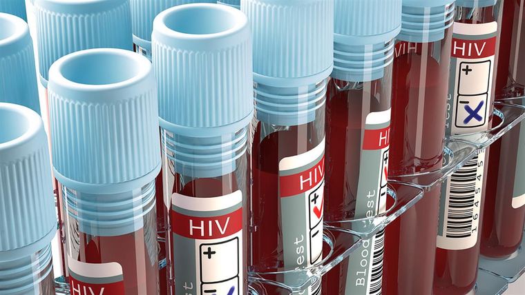 Μετάλλαξη του  HIV ανακαλύφθηκε στην Ολλανδία