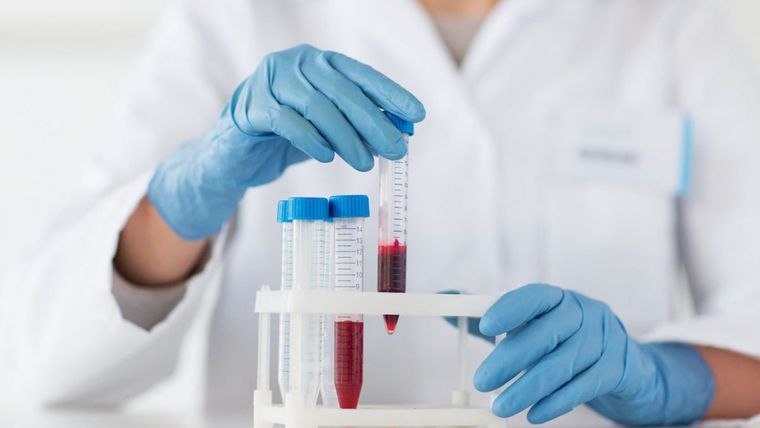 Νέο τεστ αίματος προβλέπει τον κίνδυνο εμφράγματος και εγκεφαλικού με μεγάλη ακρίβεια