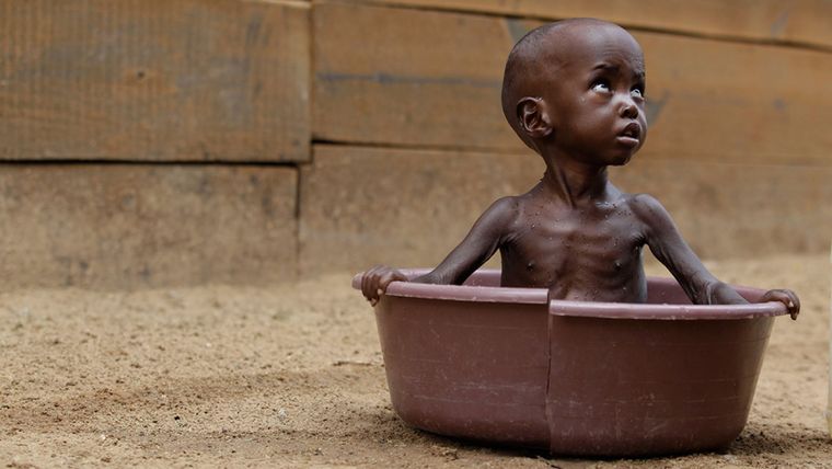 Η UNICEF προειδοποιεί για «καταστροφικά» επίπεδα παιδικού υποσιτισμού εξαιτίας της ανόδου των τιμών των τροφίμων