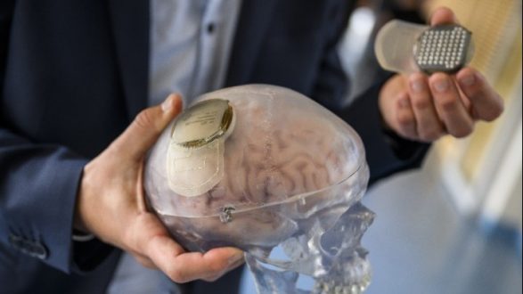  Μασκ: Εγκεφαλικά εμφυτεύματα σε ανθρώπους θα δοκιμάσει η start-up Neuralink 