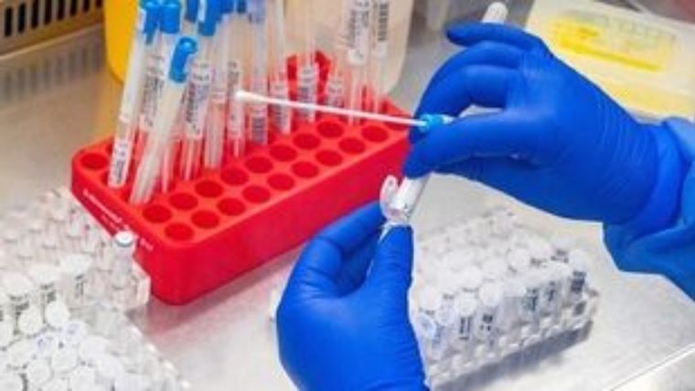 ΕΟΔΥ: Δωρεάν έλεγχος για τα Σεξουαλικά Μεταδιδόμενα Νοσήματα